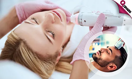 Radio Frequency Microneedling Skin Treatment for Ladies & Men!